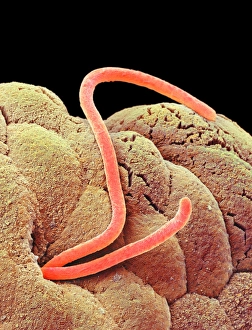 Scanning Electron Micrograph SEM Images Impressions: Threadworms in the gut, SEM
