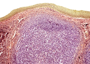 Immune System Cells Impressions: Tonsil, light micrograph