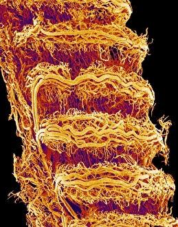 Images datées du 9 septembre 2004: Trachea