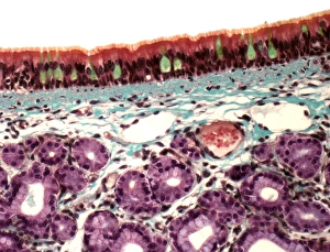 Respiratory System Anatomy Impressions: Trachea, light micrograph