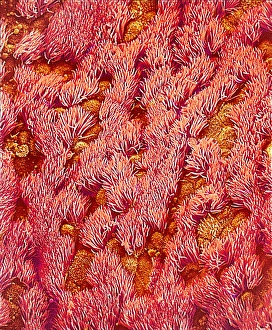 Respiratory Tract Anatomy Impressions: Trachea, SEM