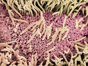 Images datées de 2005 janvier: Bas du ver à l'âme, SEM