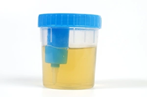 Impressions de Échantillon d'urine dans un verre Images datées de 2010 août: Échantillon d'urine