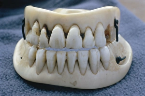 Impressions de Les dents de Waterloo fausses. Ces dentures victorienne sont faites à partir de vraies dents insérées dans l'ivoire (à la fois au haut et bas) Images datées de 2003 novembre: Dents fausses de Waterloo