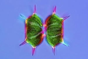 Polarised Light Microscopy Impressions: Xanthidium desmids, light micrograph