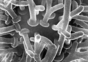 Electron Microscope Images Impressions: Synaptic Knobs First Photographed