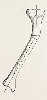 Antique Surgical Instruments Impressions: A B C