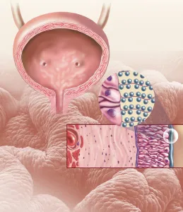 Female Reproductive System Anatomy Impressions: Detail of the cellular structure that forms the bladder lining