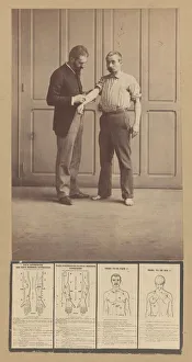 Alphonse Bertillon Impressions: Notation of Scars, Schematic Drawings, ca. 1893. Creator: Alphonse Bertillon