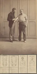 Notation des cicatrices, Dessins schématiques, environ 1893. environ 1893. Créateur : Alphonse Bertillon