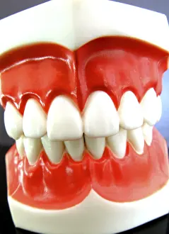Dental Prosthesis Impressions: False teeth