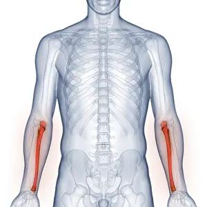 X Ray Examination Impressions: Image converted using ifftoany