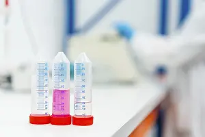 Medical Examination Process Impressions: Three tubes with samples in the table of a laboratory with someone working on the background