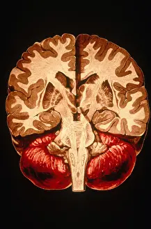 Human Brain Anatomy Impressions: Brain, Coronal Section