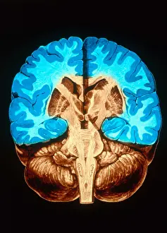 Human Brain Anatomy Impressions: Brain, Coronal Section