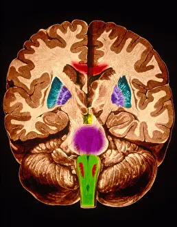 Human Nervous System Impressions: Brain, Coronal Section