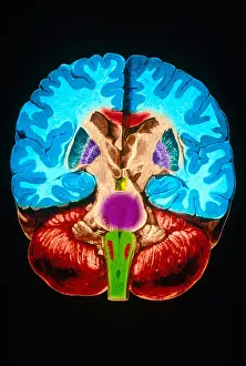 Cerebral Cortex Illustration Impressions: Brain, Coronal Section