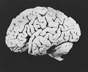 Central Nervous System Diagram Impressions: Human brain