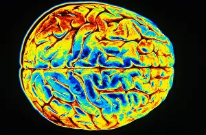 Nervous System Diagrams Impressions: Human Brain