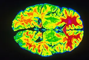 Magnetic Resonance Imaging Impressions: Human Brain