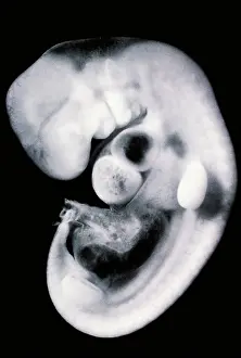 Scanning Electron Microscope Images Impressions: Human embryo