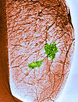 Medical Imaging Techniques Impressions: Mammogram