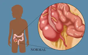 Human Digestive System Illustration Impressions: Normal Appendix
