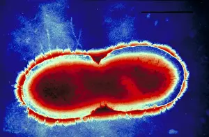 Electron Microscopy Images Impressions: Pseudomonas cepacea