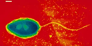 Electron Microscopy Images Impressions: Pseudomonas cepacea