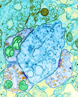 Nerve Cell Anatomy Impressions: Synapse, TEM