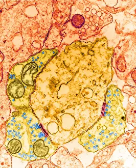 Transmission Electron Microscopy (TEM) Impressions: Synapse, TEM